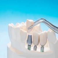 Bergens Periodontics & Implant Dentistry Daytona image 2